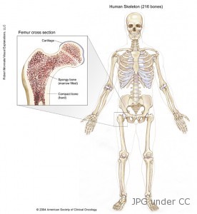 bone cancer