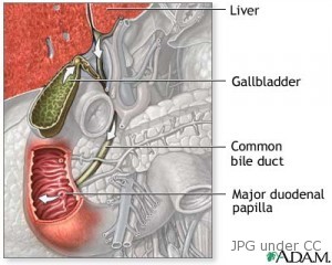 bile duct cancer