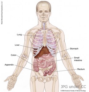 carcinoid cancer