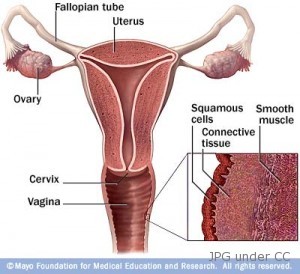 vaginal cancer